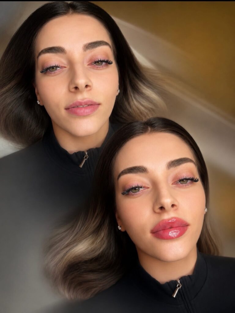 💋✨ Lip Filler & Botox – poza 2